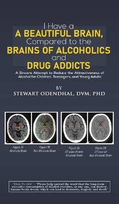I Have a Beautiful Brain, Compared to the Brains of Alcoholics and Drug Addicts