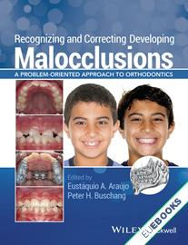 Recognizing and Correcting Developing Malocclusions : A Problem-Oriented Approaches to Orthodontics