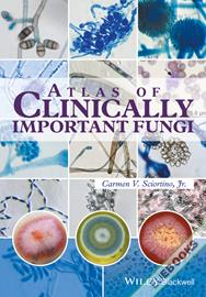 Atlas of Clinically Important Fungi